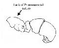 ../images/proceratiumbody.web.jpg