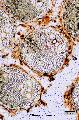 ../images/Chamaerops_humilis_10_2.jpg